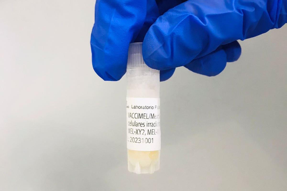 Argentina presentó “Vaccimel”, la primera vacuna nacional contra el cáncer de piel
