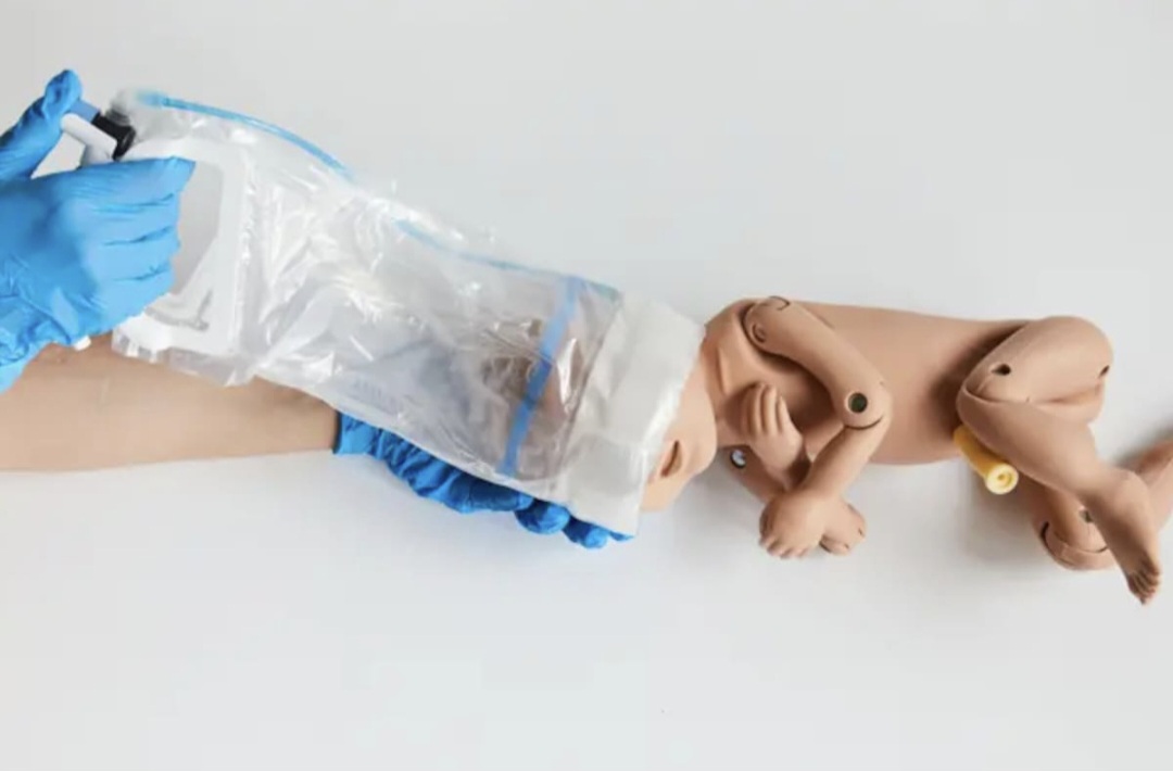 Quiso ayudar a que naciera su hijo y terminó creando un dispositivo utilizado en hospitales